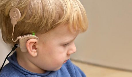 Implant coclear en un nen