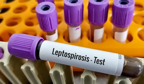 Tub amb Leptospirosi