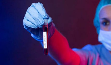 Test sanguini de Covid