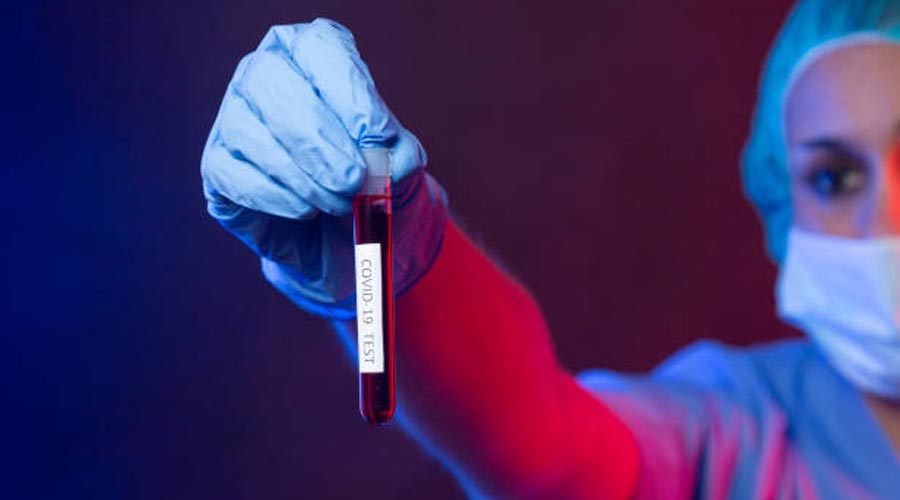 Test sanguini de Covid
