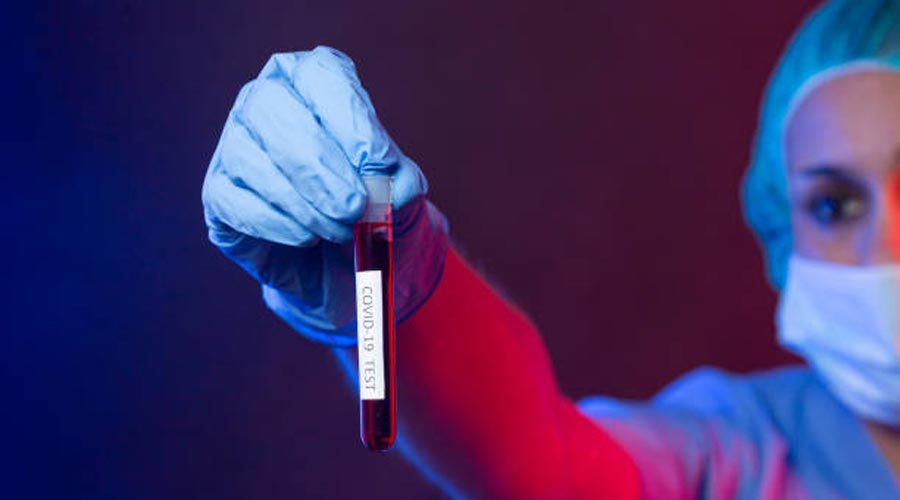 Un tub amb una mostra de Covid