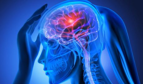 Radiografia del cap d'una persona tractada amb quimioteràpia