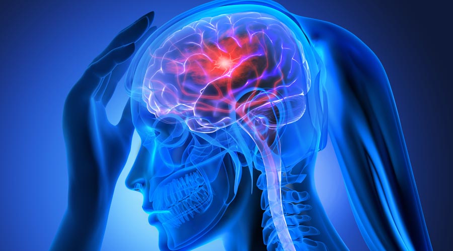 Radiografia del cap d'una persona tractada amb quimioteràpia