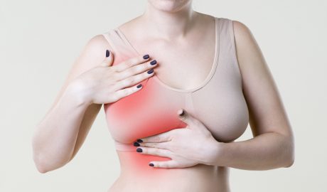 Una dona patint de mastitis