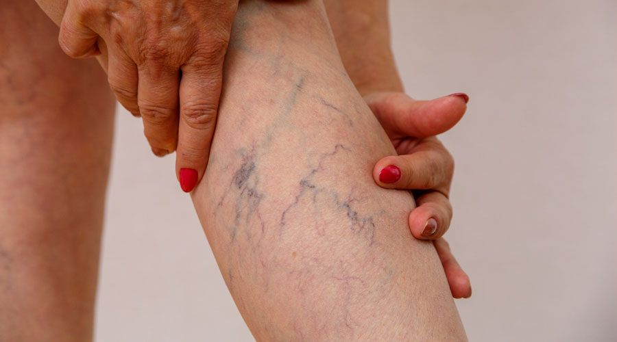 Una cama amb varius (Getty images)