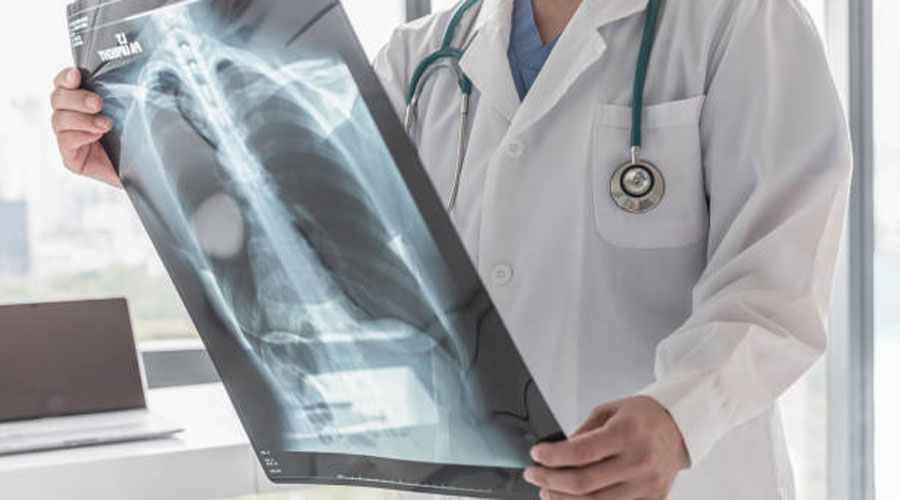 Un metge estudiant una radiografia (Pexels)