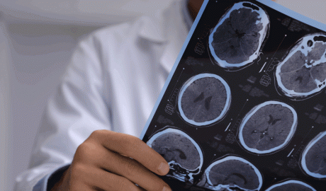 Un metge observant les proves d'una ressonància magnètica a un cervell