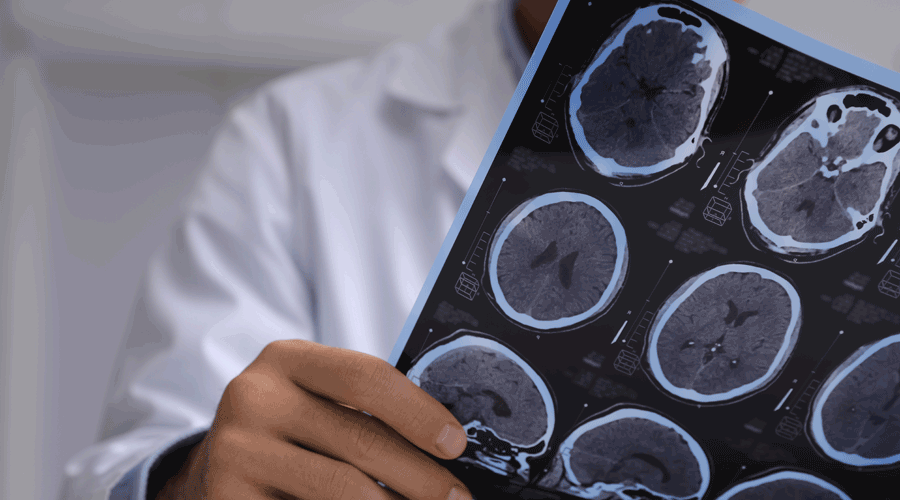 Un metge observant les proves d'una ressonància magnètica a un cervell (Getty images)