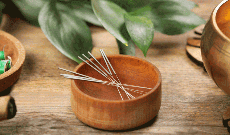 Agulles d'acupuntura