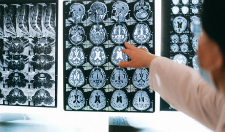 Unes radiografies odontològiques