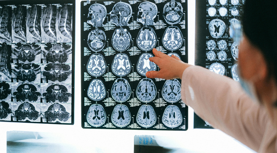 Unes radiografies odontològiques (SFGA)