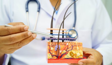 Una intervenció es realitza sota anestèsia local i pot durar entre 4 i 8 hores