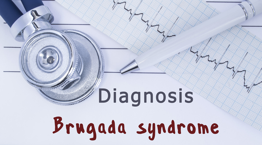 La síndrome de Brugada afecta el sistema elèctric del cor