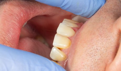 Un home en un dentista