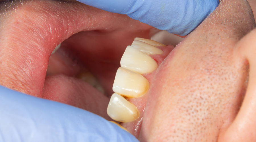 Un home en un dentista