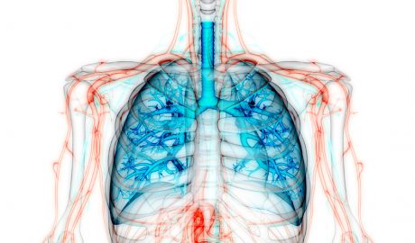 La fibrosi pulmonar dificulta la capacitat dels pulmons per a funcionar correctament