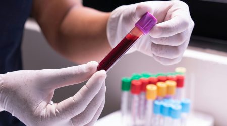 Una mostra de sang per a ser analitzada