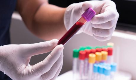 Una mostra de sang per a ser analitzada